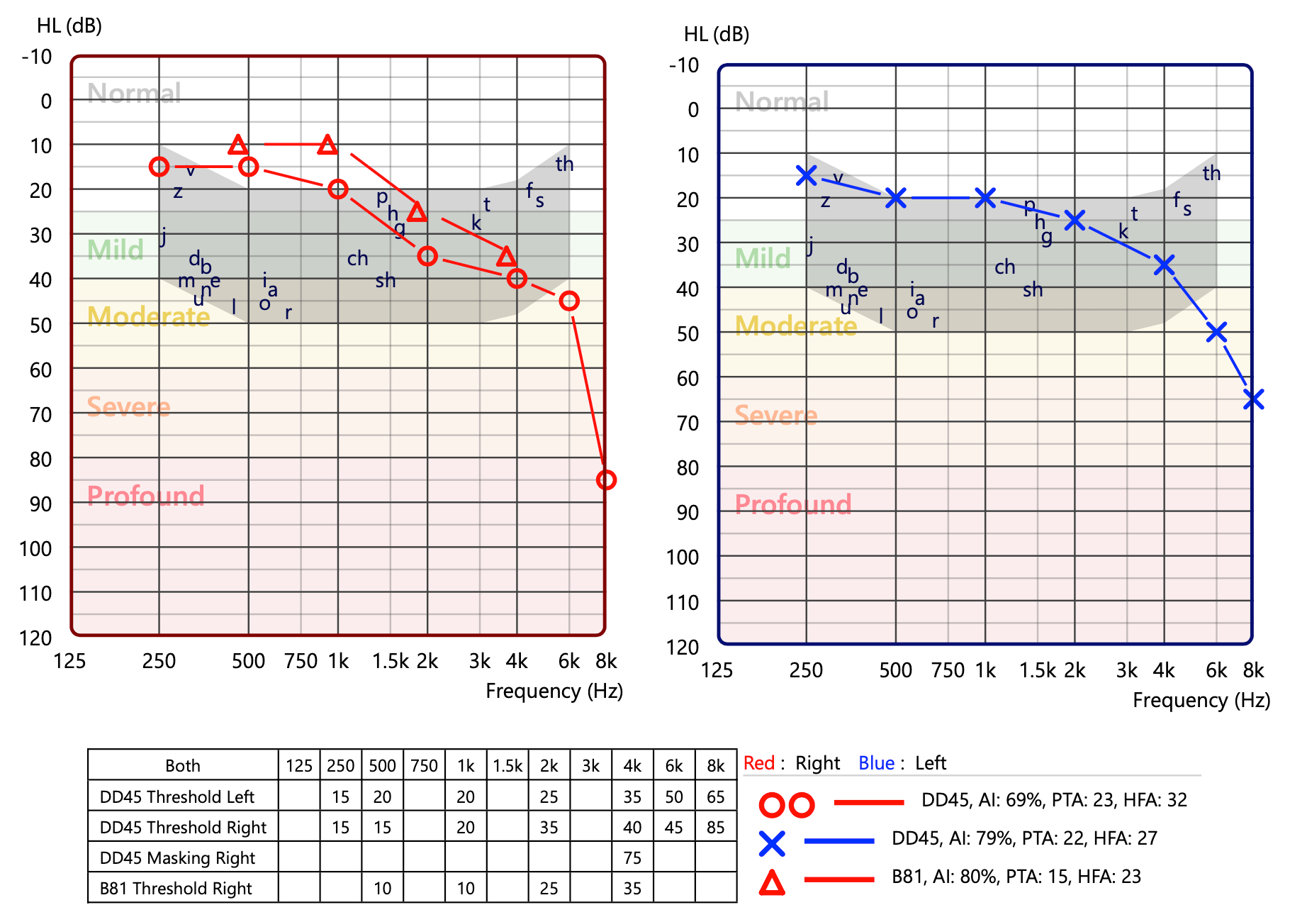 Hearing charts